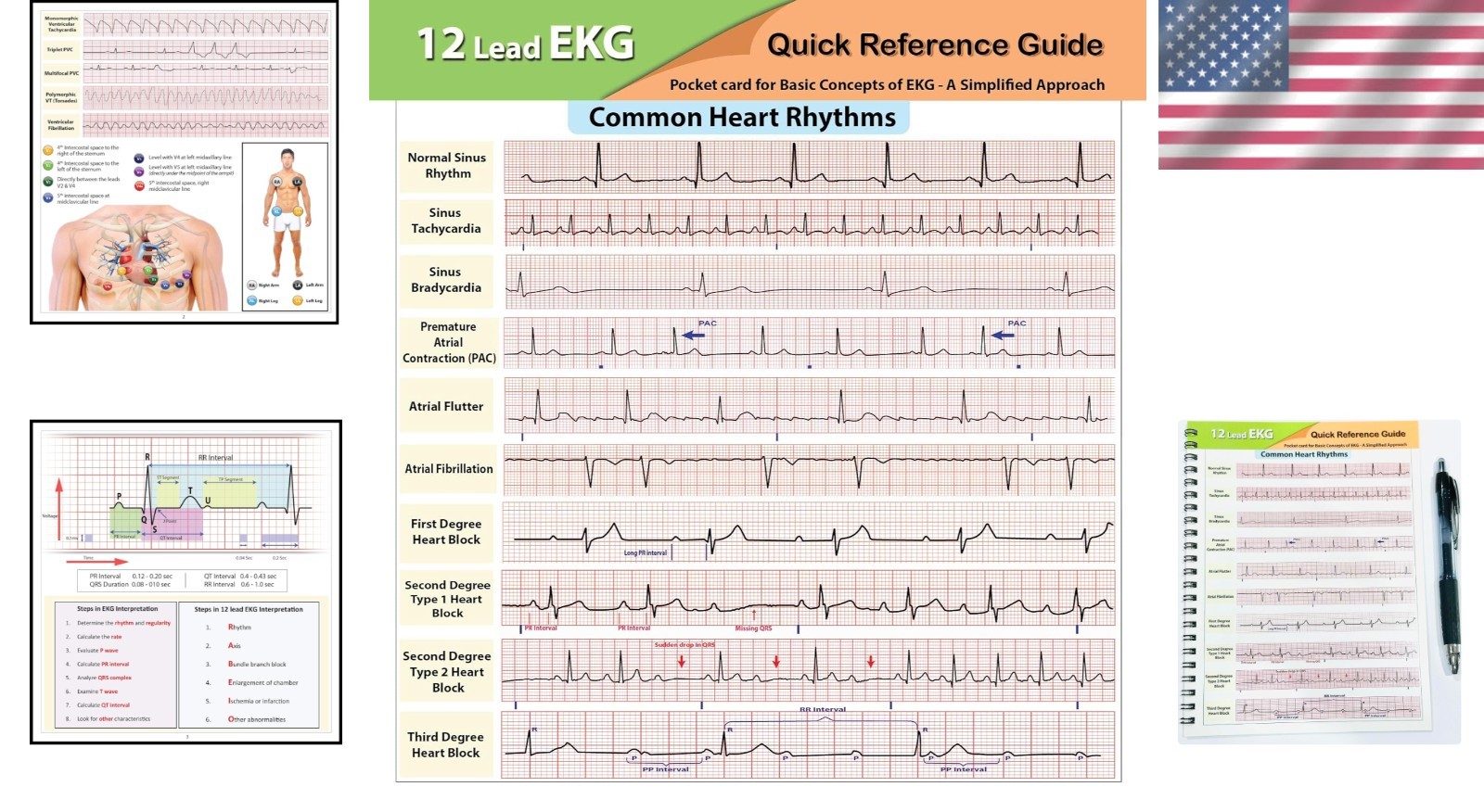 12 Lead EKG Pocket Card