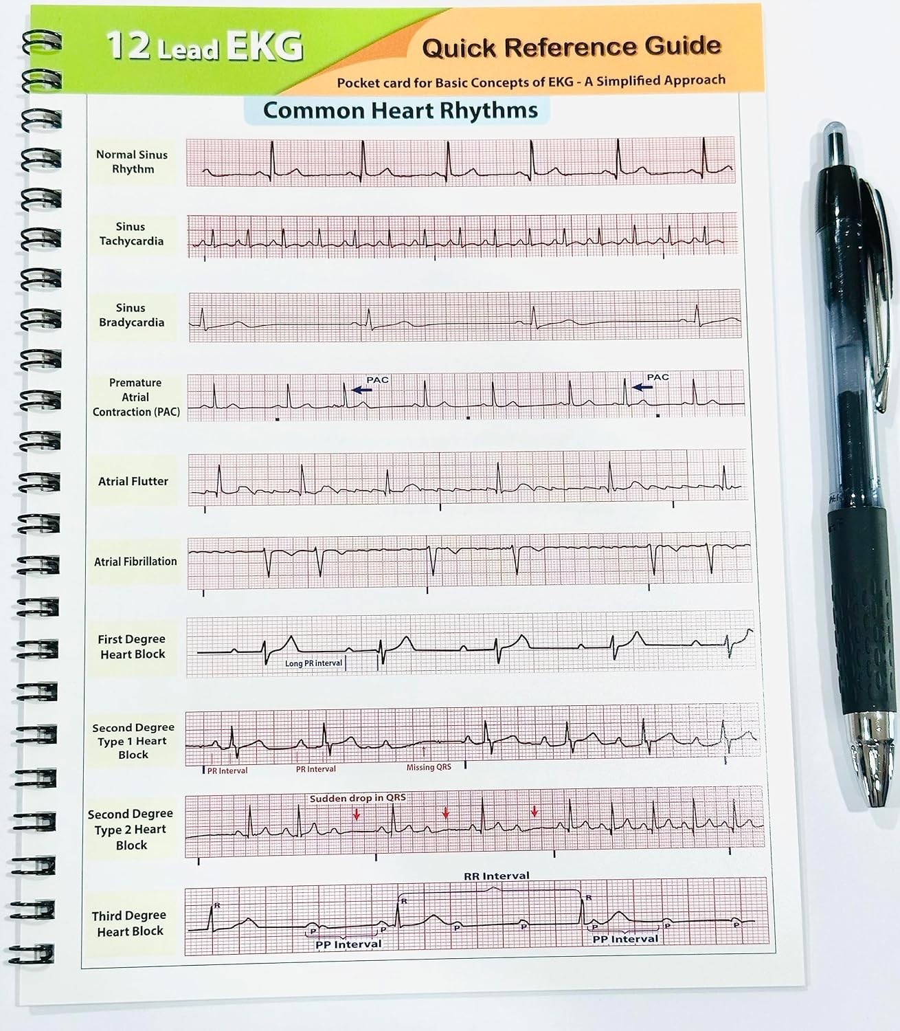 12 Lead EKG Pocket Card