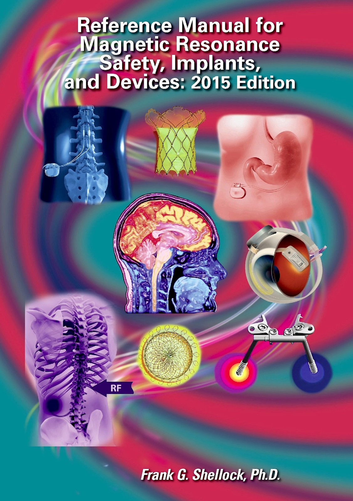 Reference Manual for Magnetic Resonance Safety, Implants and Devices 2015 – …