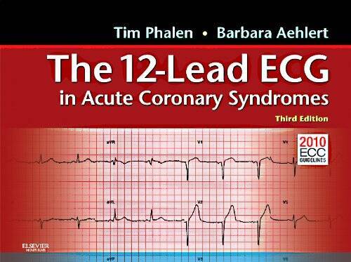 The 12-Lead ECG in Acute Coronary Syndromes: Pocket Reference for the 12- – GOOD