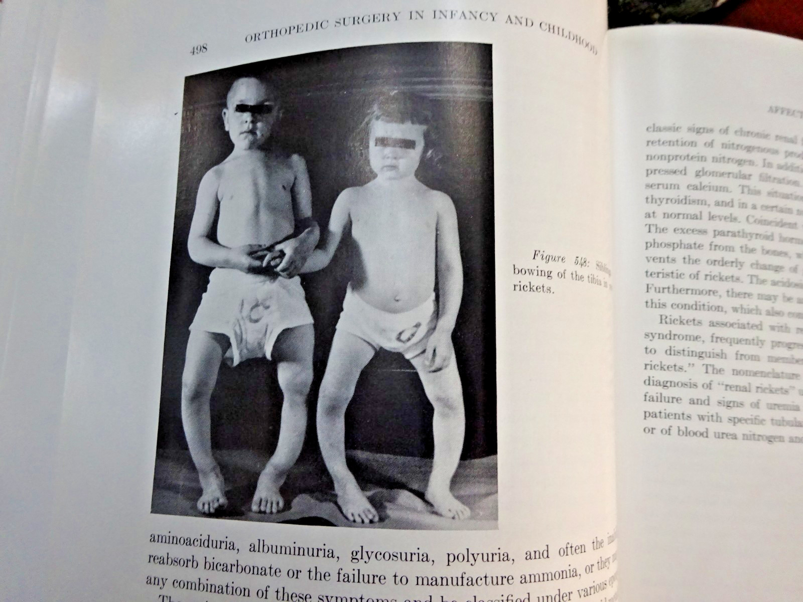 The Surgery of Infancy and Childhood 1963 Hard Cover with index 650 pages