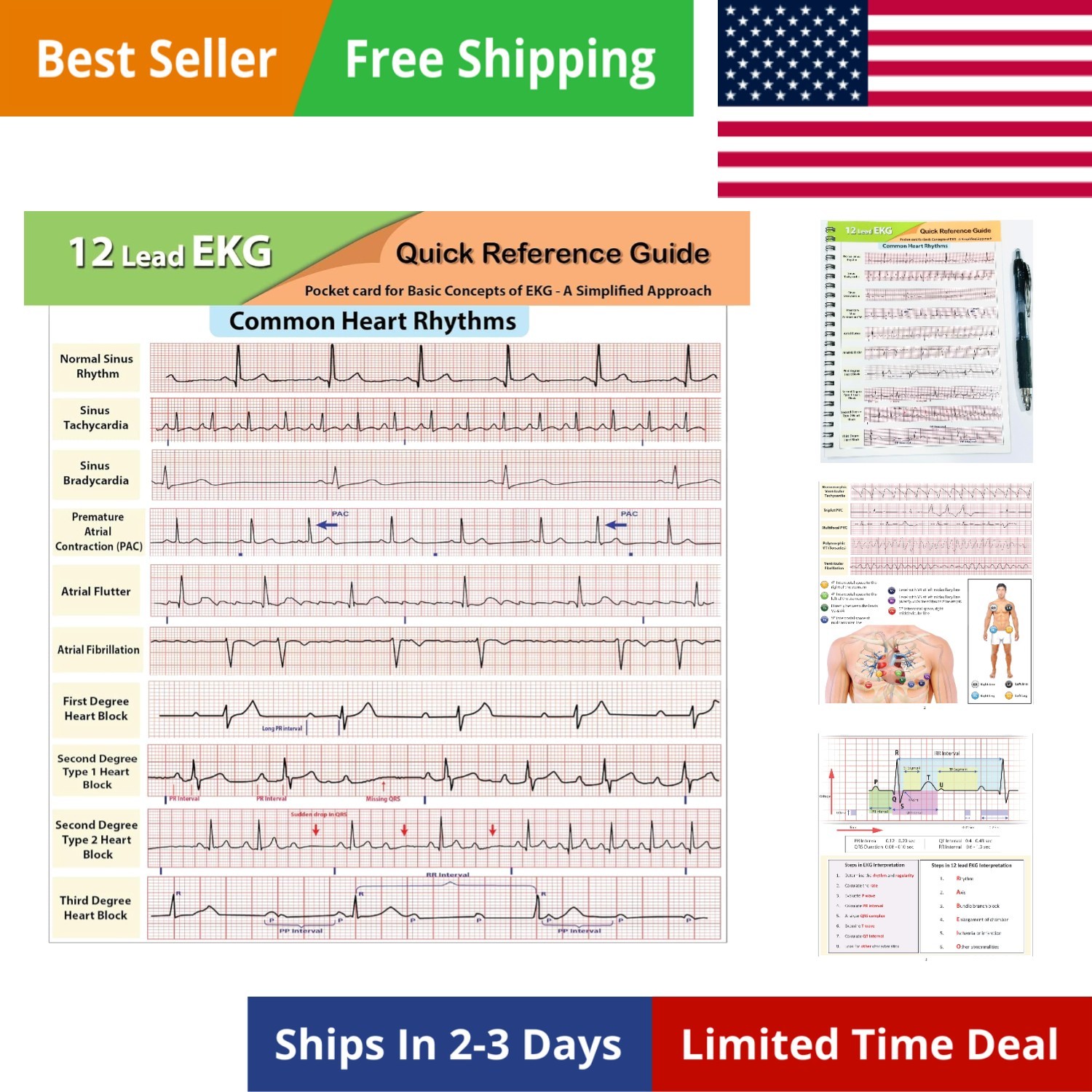 12 Lead EKG Pocket Card