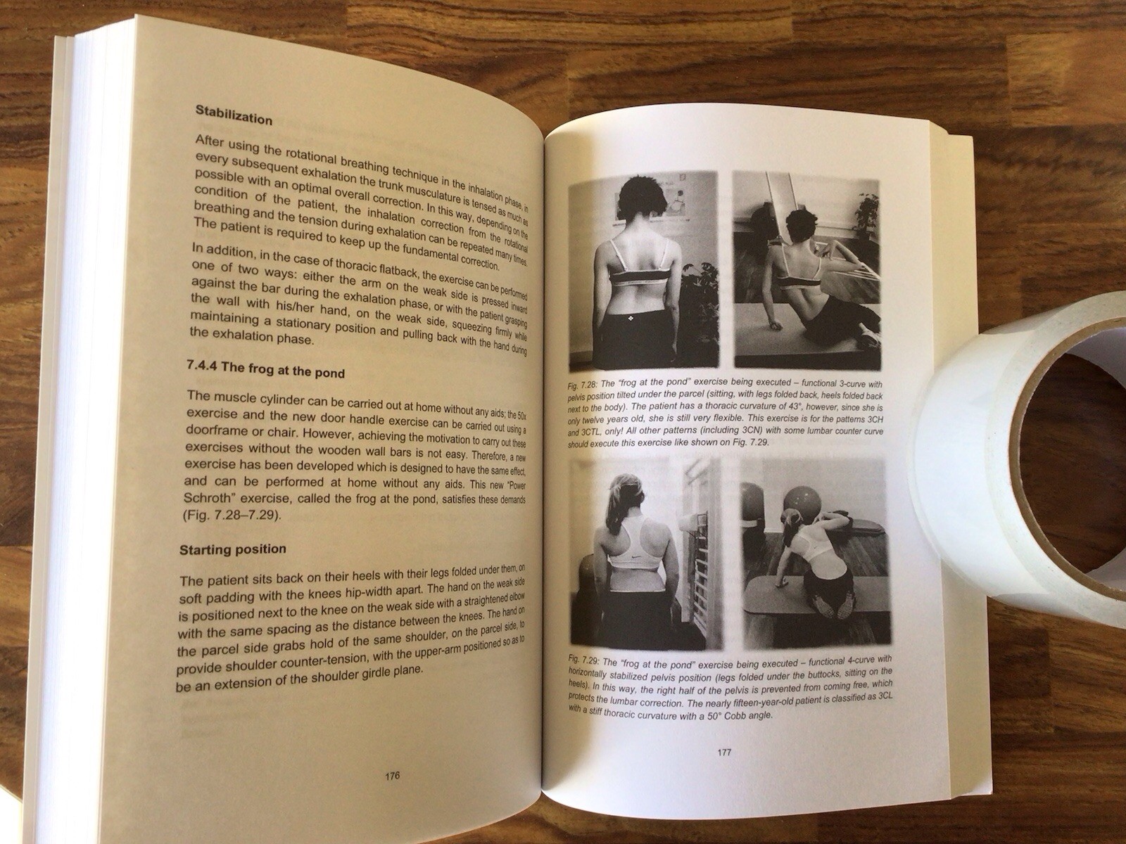 Schroth Therapy by Weiss, Moramarco, and Lehnert-Schroth, Scoliosis treatment