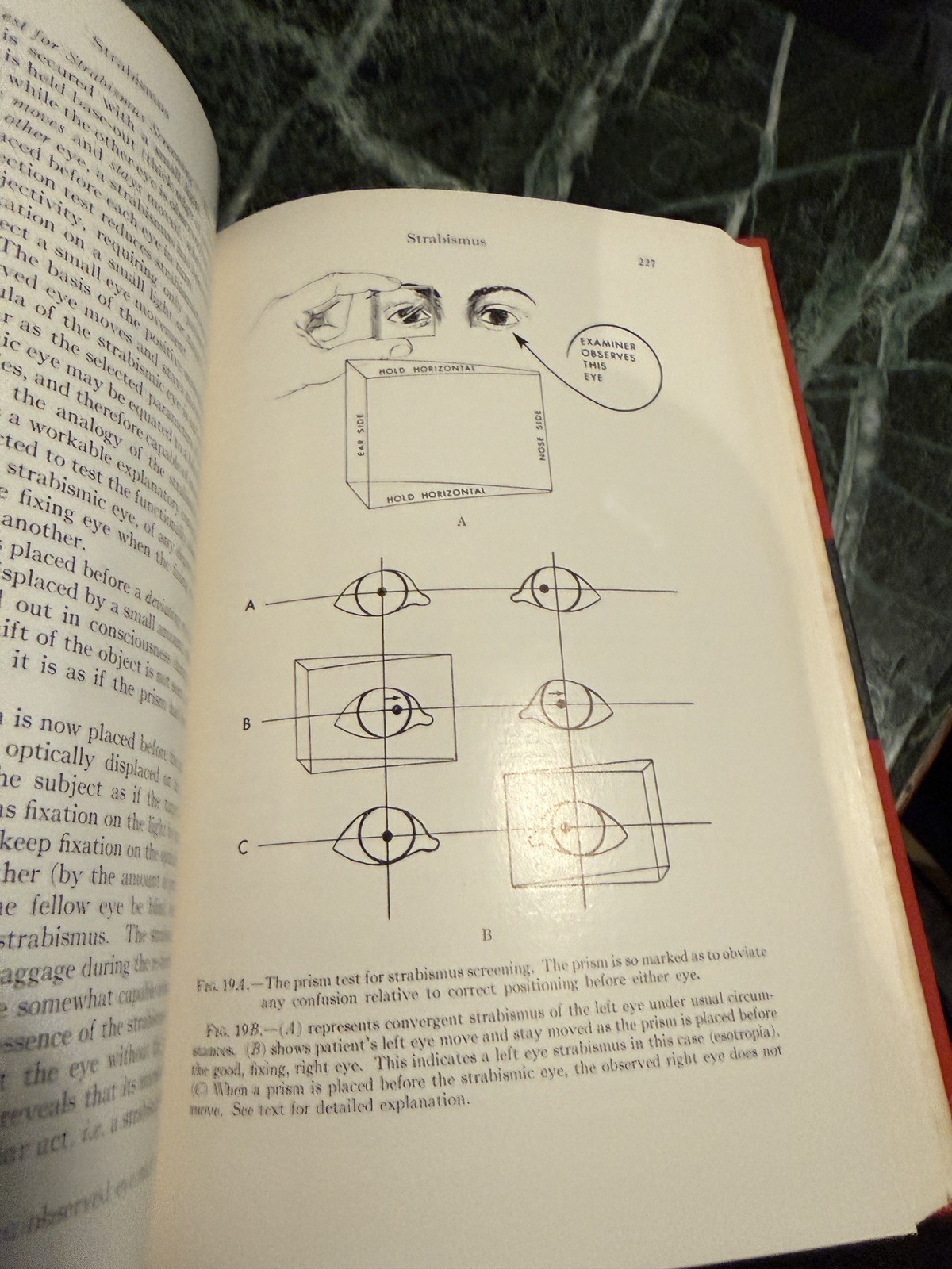 Pediatric Ophthalmology by L Byerly Holt Hardcover Book 1964 Excellent Cond