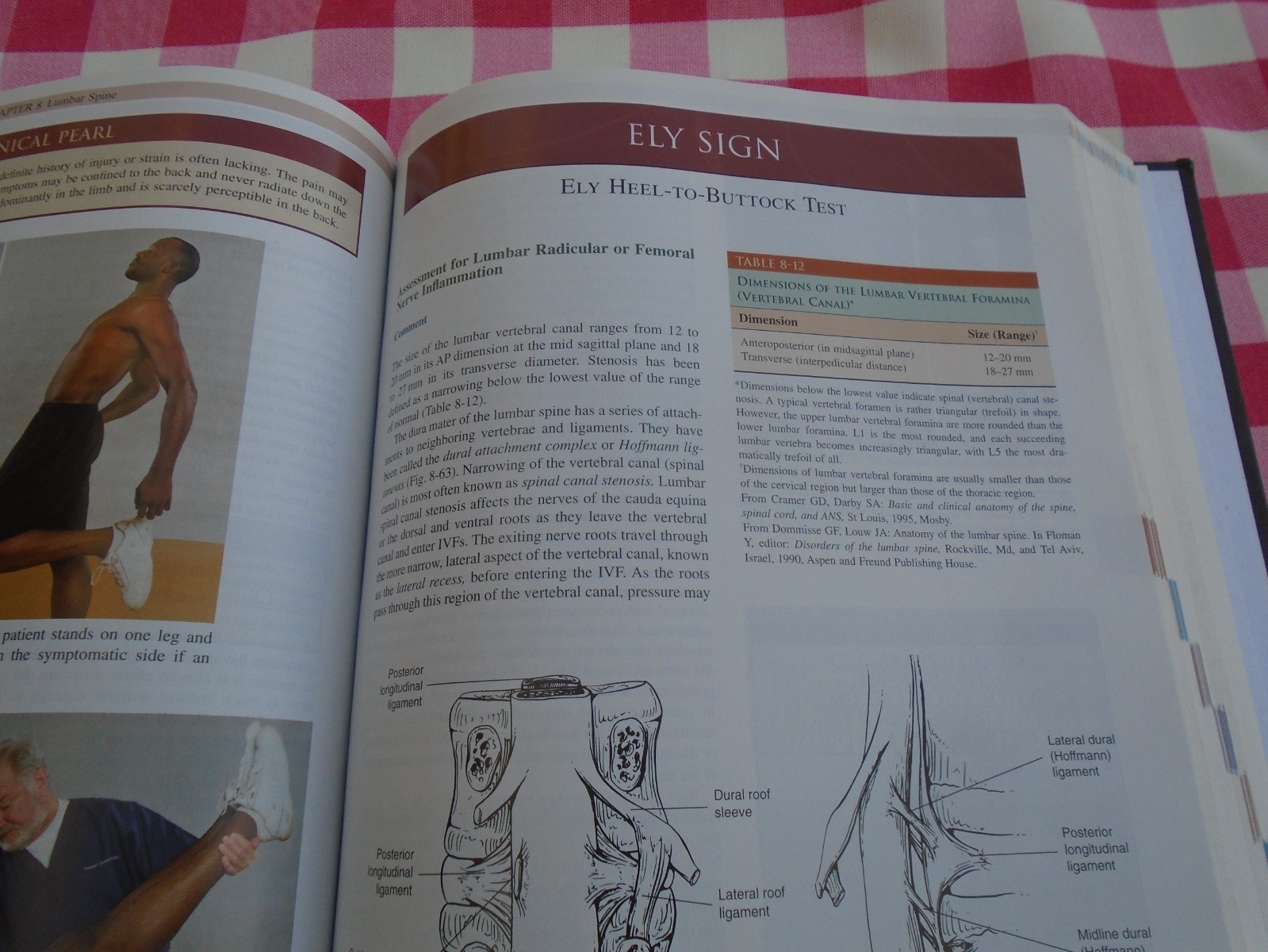 Illustrated Orthopedic Physical Assessment 3rd Edition By Ronald C. Evans