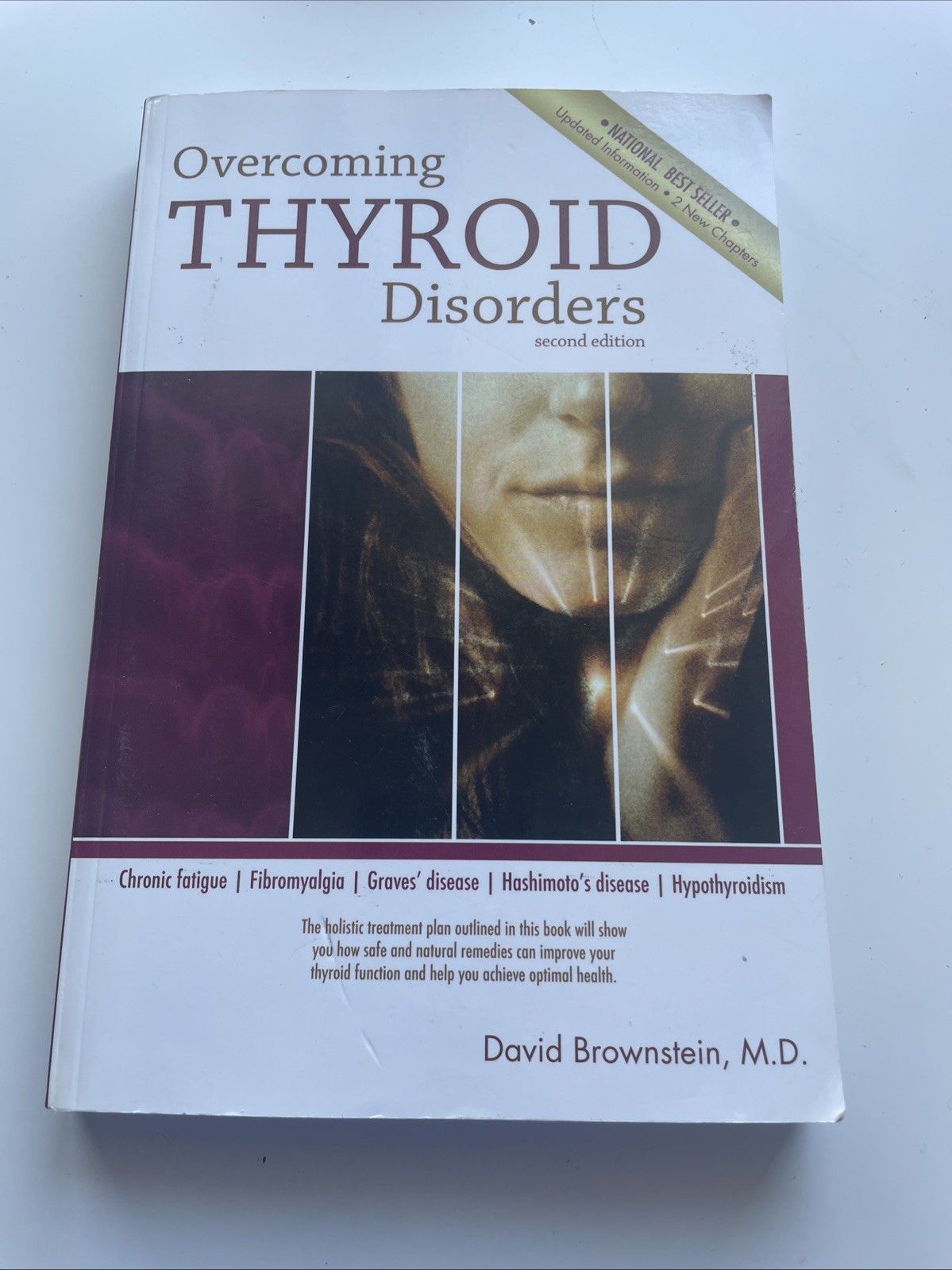 Overcoming Thyroid Disorders by Brownstein, David (2002) Paperback – paperba…