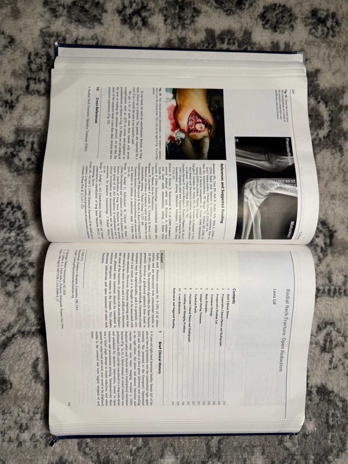 Pediatric Orthopedic Trauma Case Atlas Hardcover Medical Book Springer