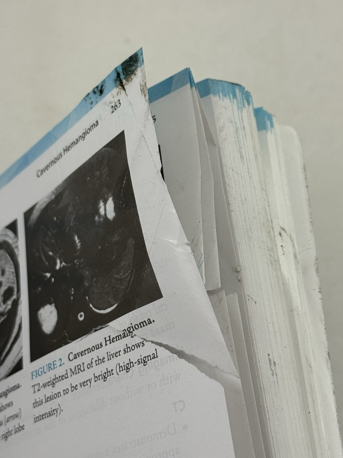 CT & MRI Pathology: A Pocket Atlas, Third Edition – Paperback, by GREY