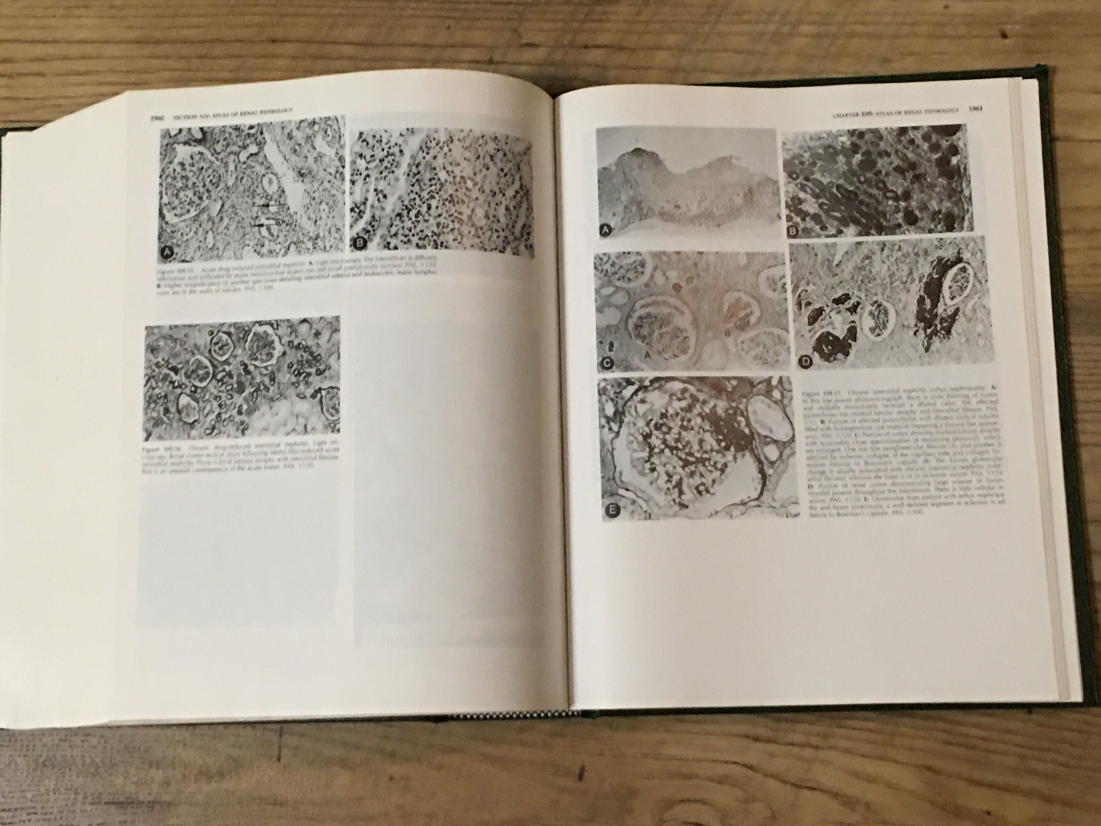 Massry And Glassock’s TEXTBOOK OF NEPHROLOGY Fourth Edition