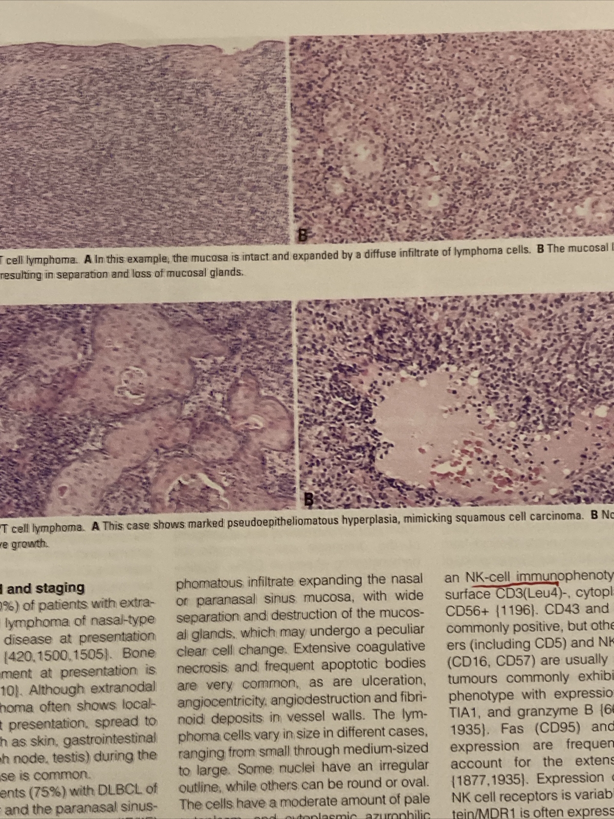 WHO Pathology and Genetics Head and Neck Tumours