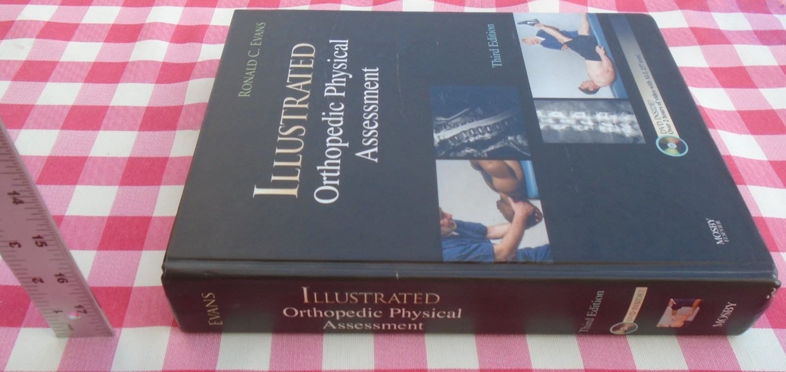 Illustrated Orthopedic Physical Assessment 3rd Edition By Ronald C. Evans