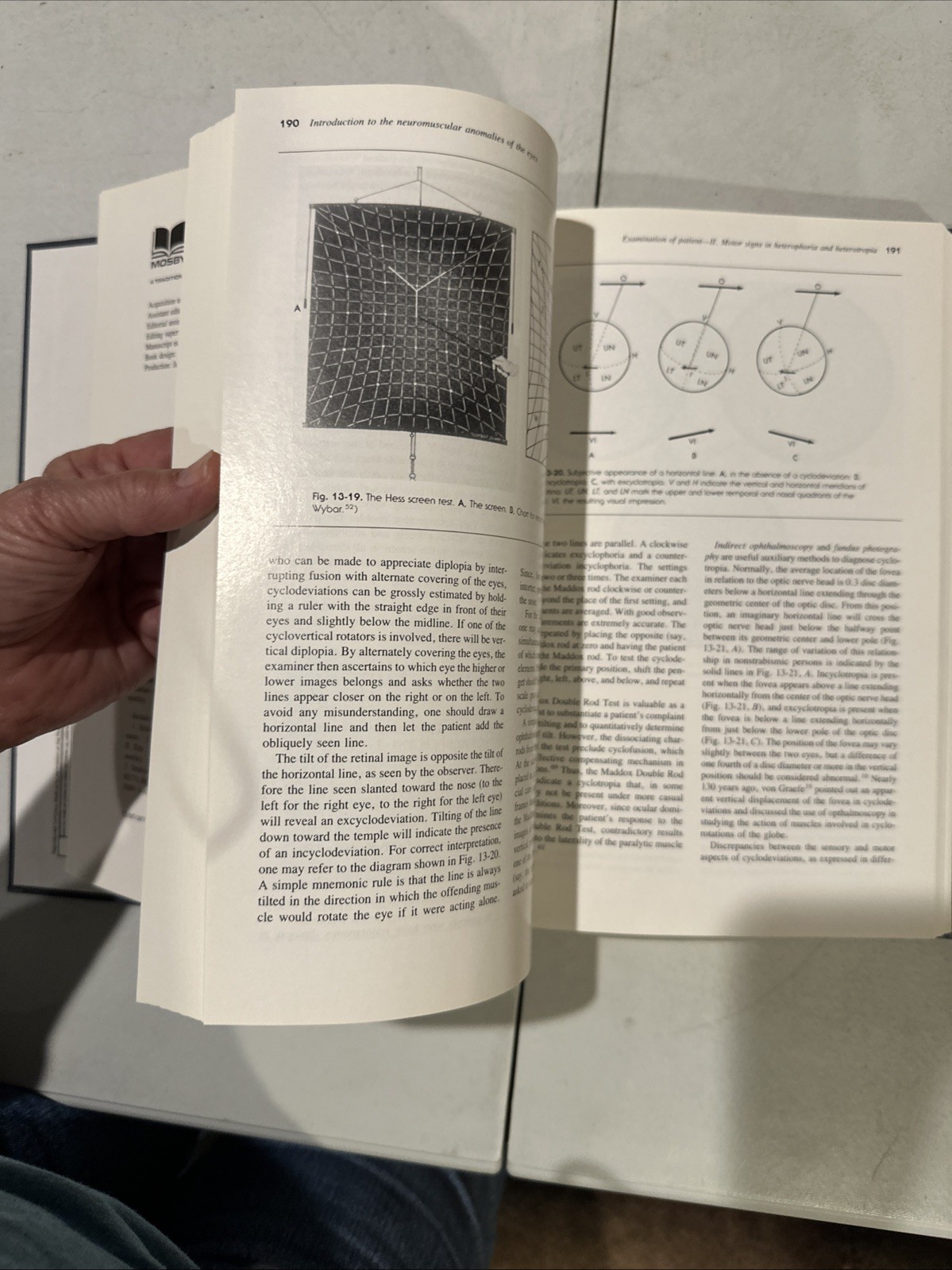 Binocular Vision And Ocular Motility. Von Noorden. 1985. Ophthalmology