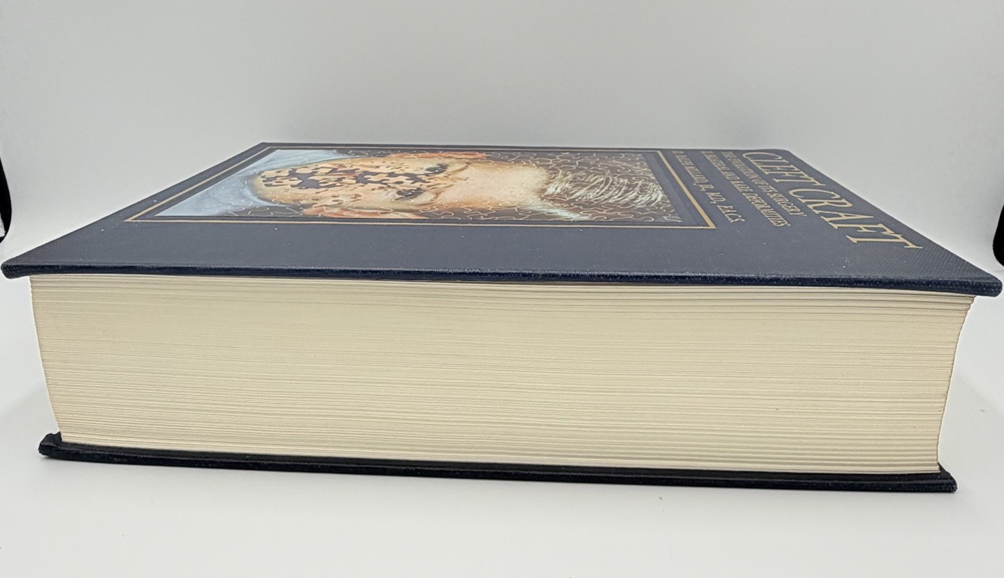 Cleft Craft Vol 2 Evolution Of Its Surgery The Unilateral Deformity Millard 1977