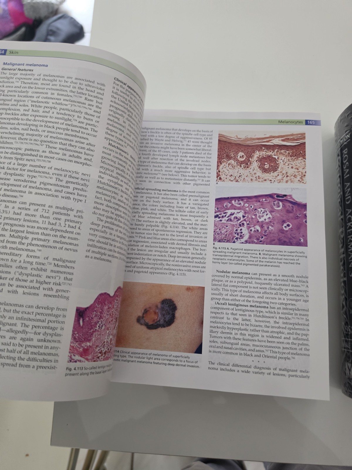 Rosai and Ackerman’s Surgical Pathology (2 Vol Set) 9th Ed HC 2004 VG- cond.