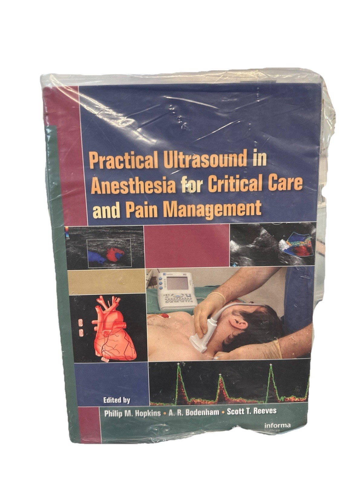 Practical Ultrasound in Anesthesia for Critical Care and Pain Management