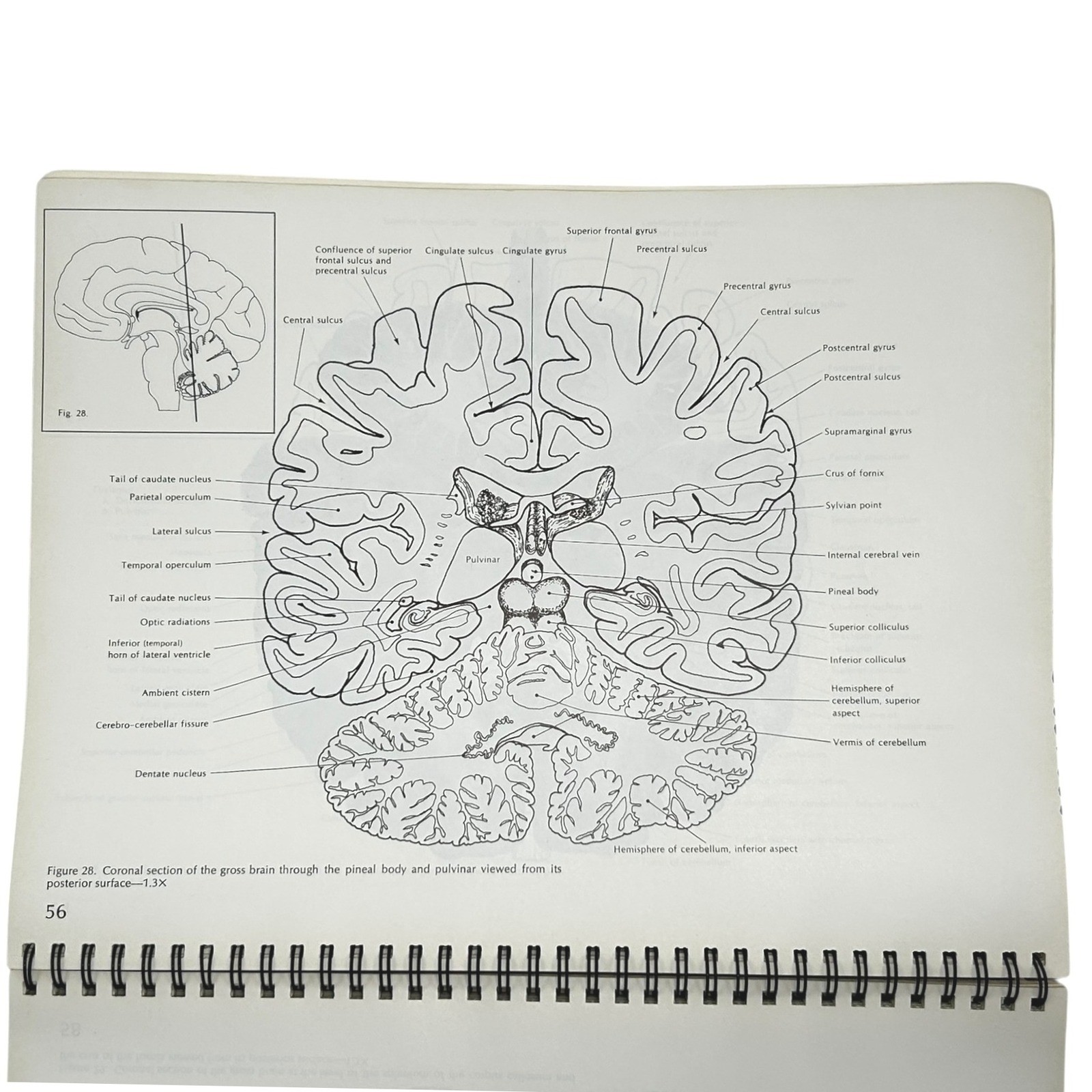 Structure of the Human Brain A Photographic Atlas Third Edition Textbook