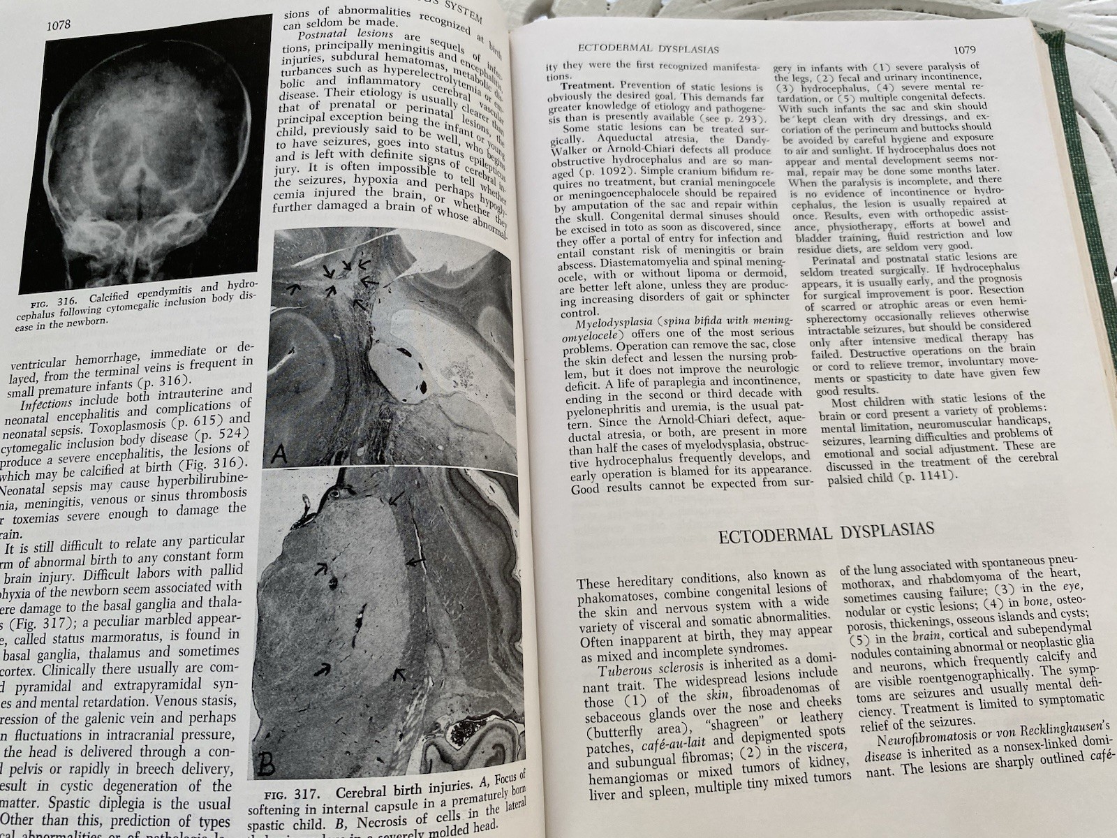 Vintage Medical Book: Textbook of Pediatrics Waldo Nelson W B Saunders 1959