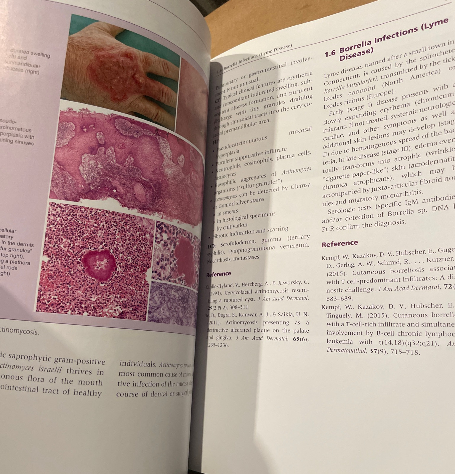 Atlas of Clinical Dermatopathology – Infectious and Parasitic Dermatoses