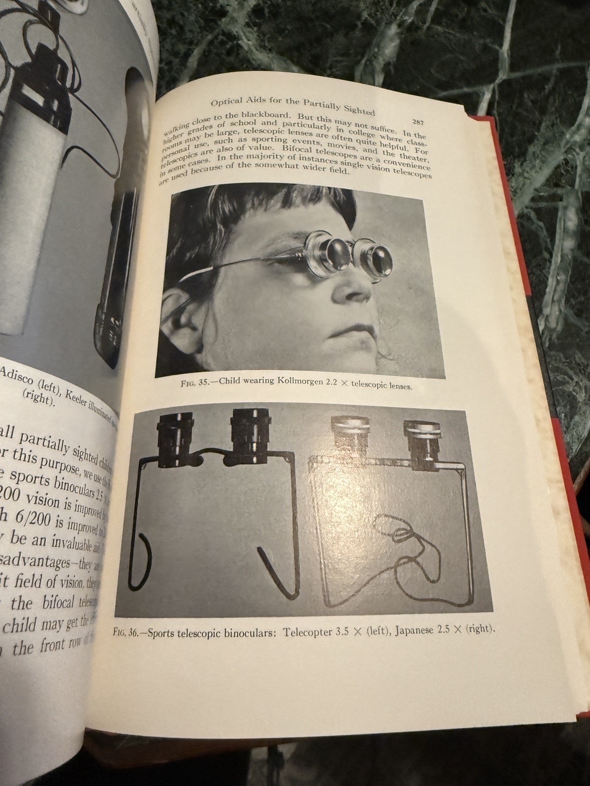 Pediatric Ophthalmology by L Byerly Holt Hardcover Book 1964 Excellent Cond