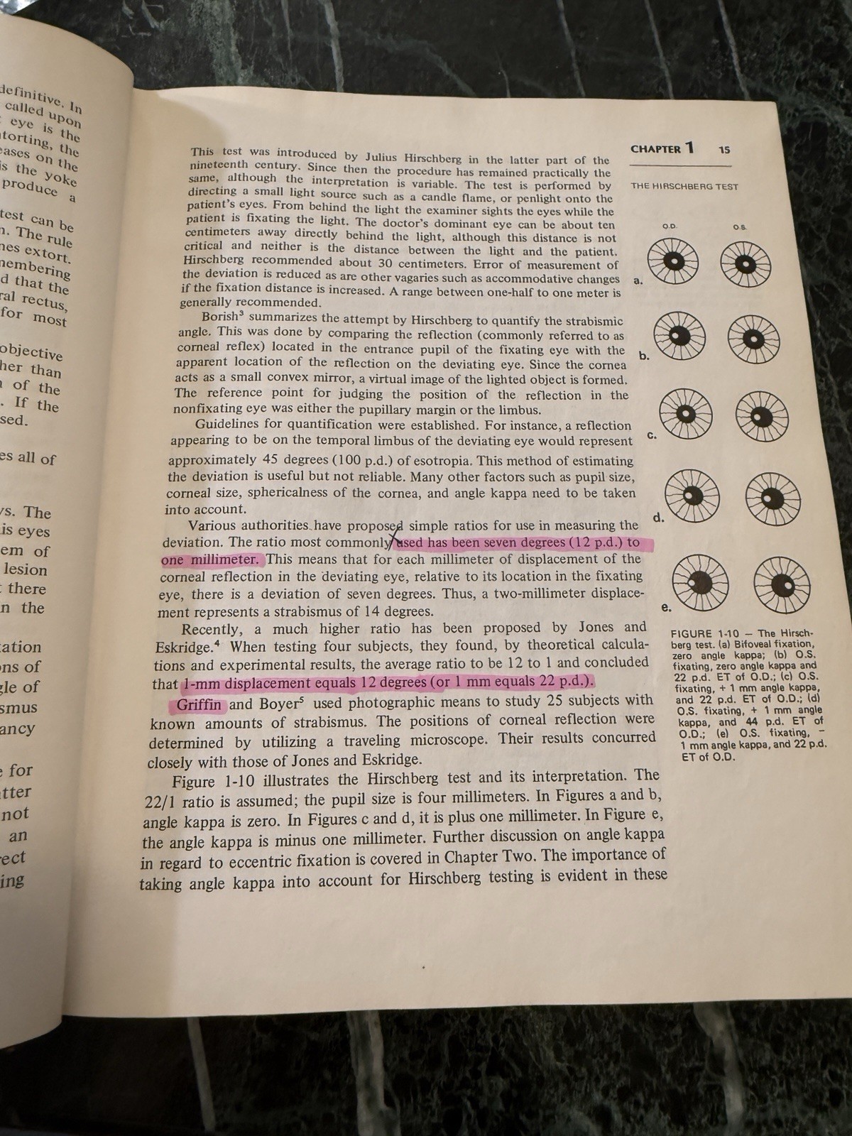 Binocular Anomalies by John R. Griffin Hardcover 1976 Professional Press Signed