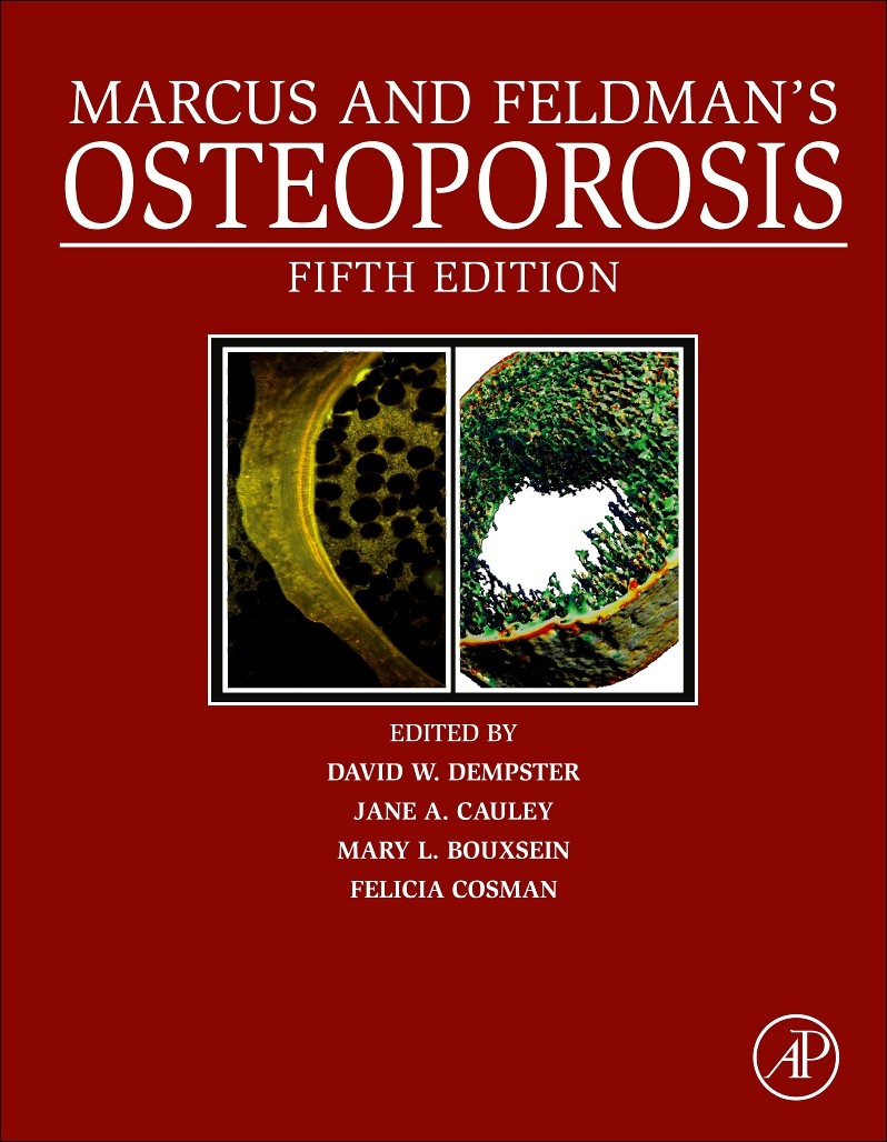 Marcus and Feldman’s Osteoporosis