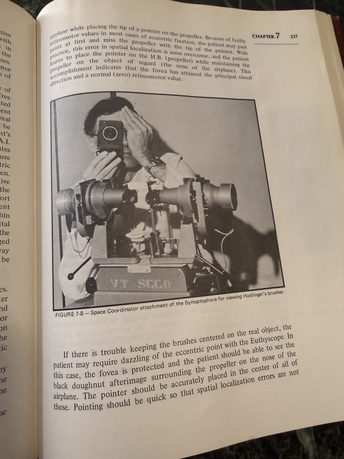 Binocular Anomalies by John R. Griffin Hardcover 1976 Professional Press Signed