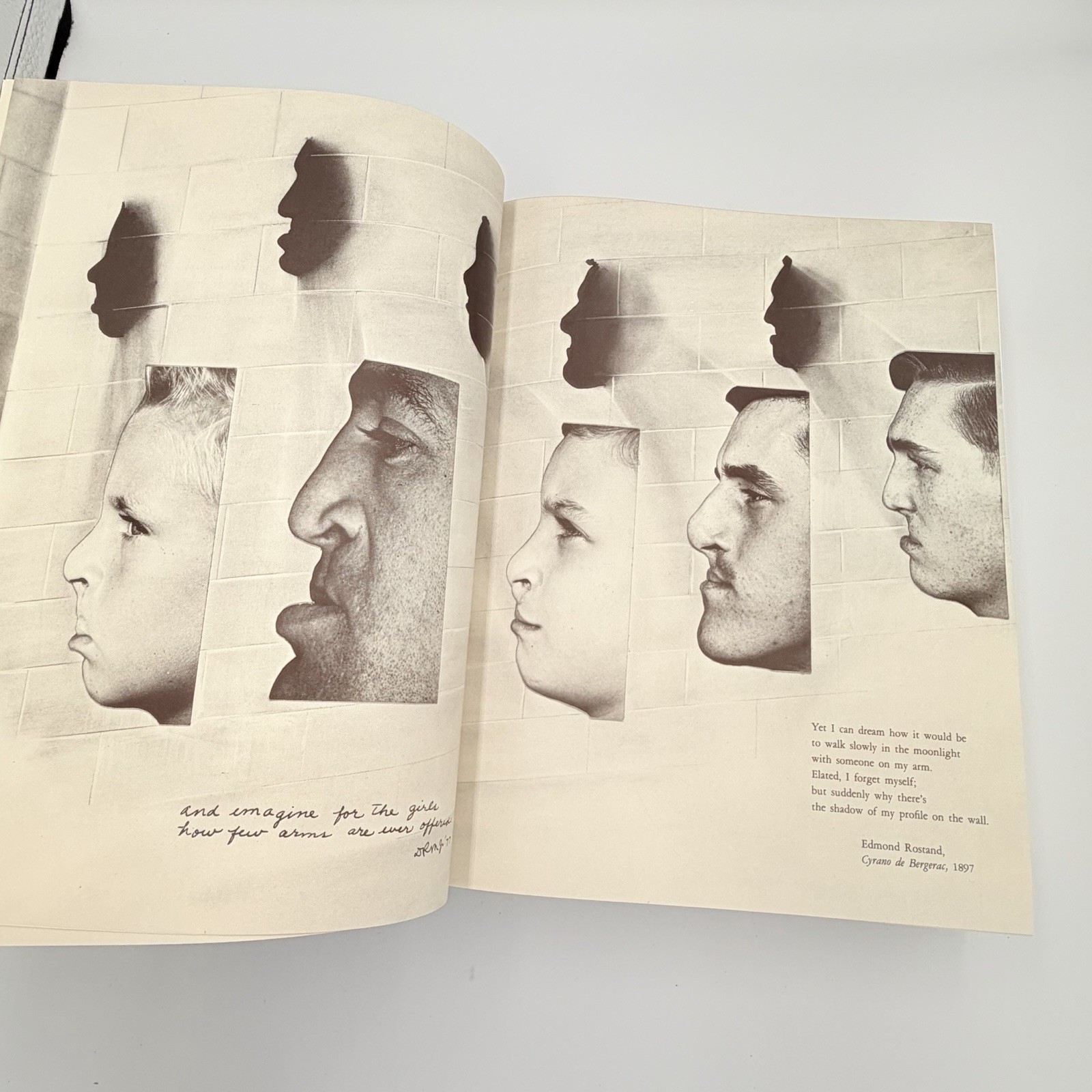 Cleft Craft Vol 2 Evolution Of Its Surgery The Unilateral Deformity Millard 1977