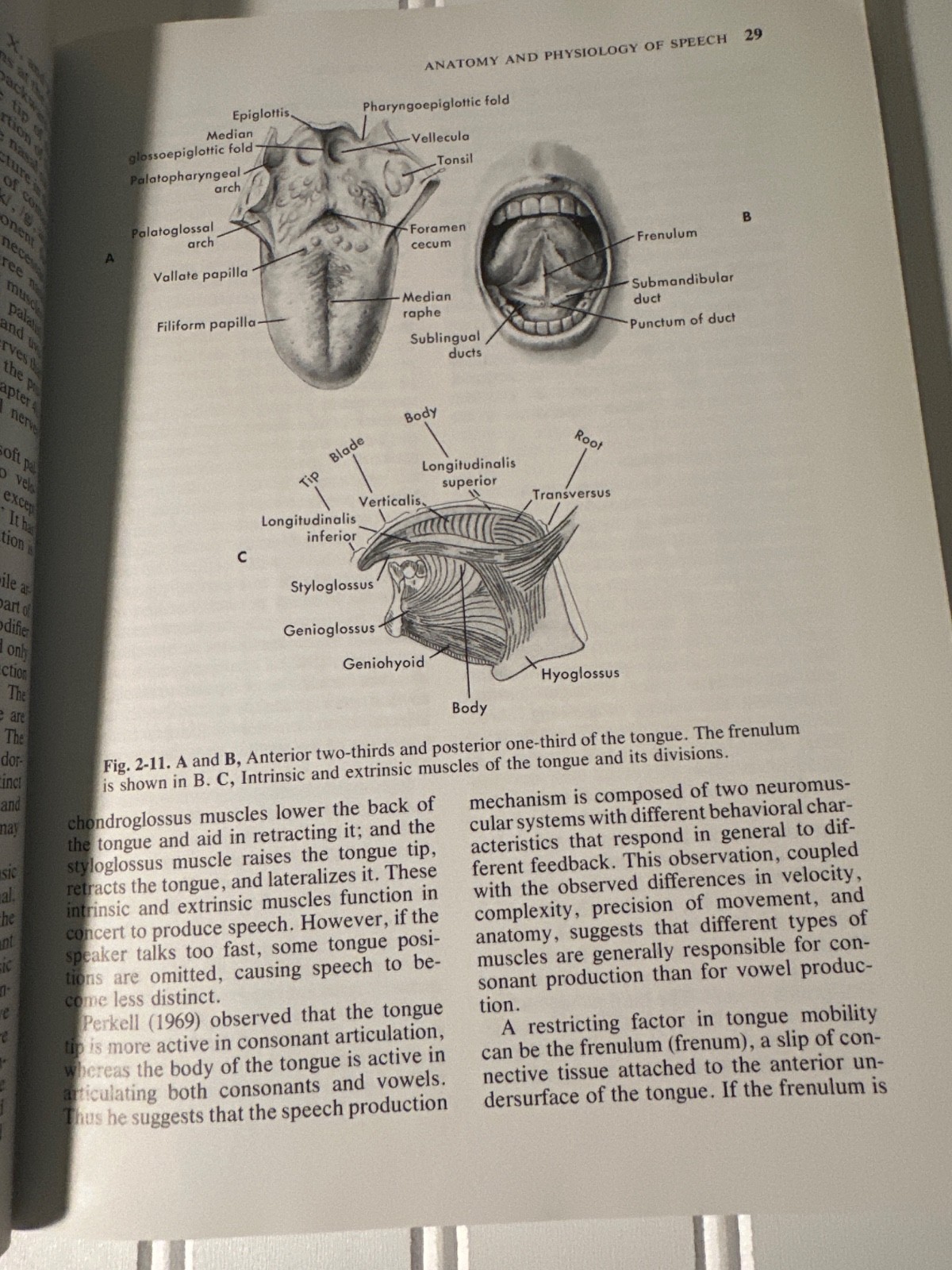 Clinical Management of Articulation Disorders