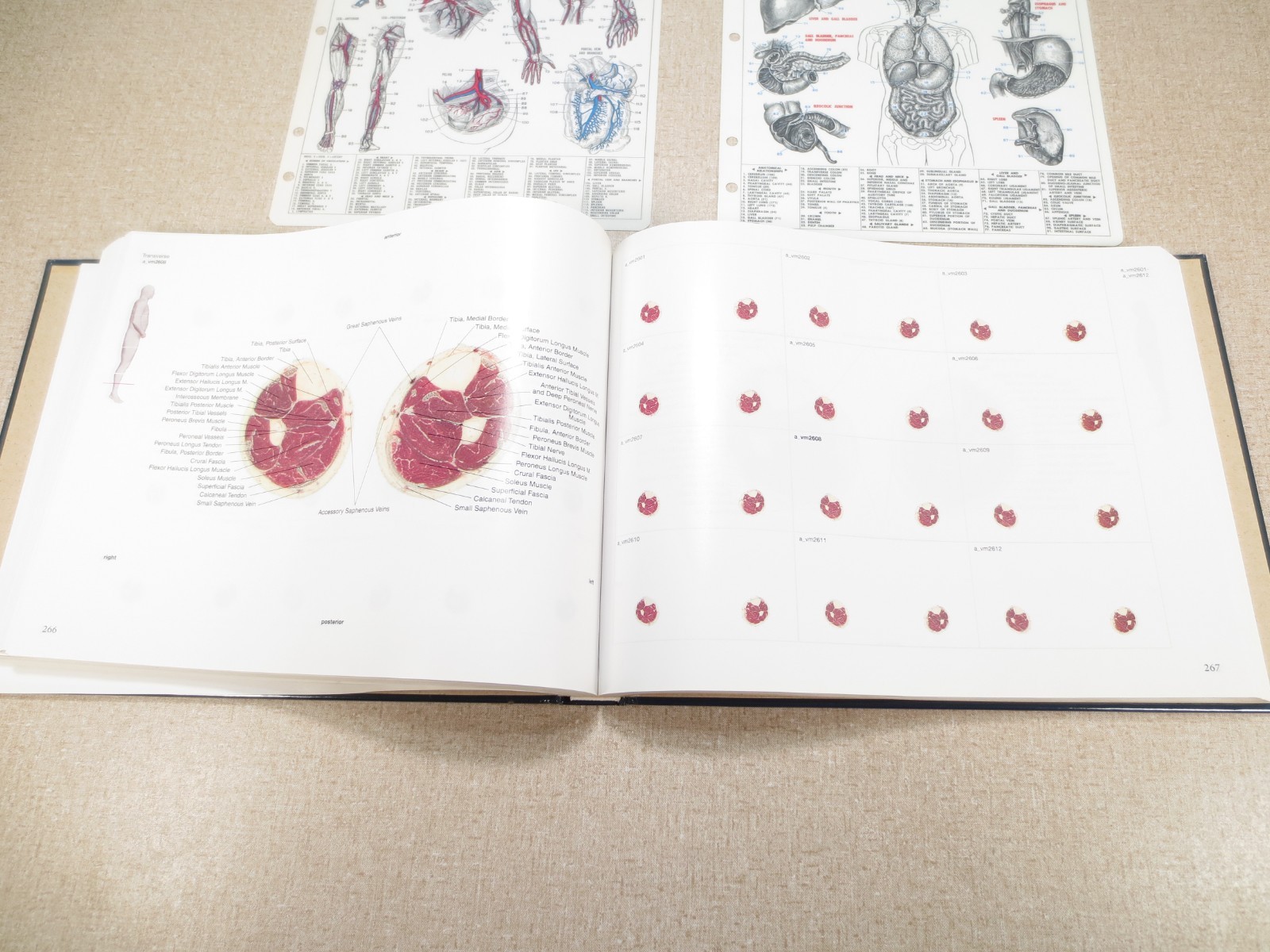 National Library of Medicine Atlas of The Visible Human Male Victor Spitzer