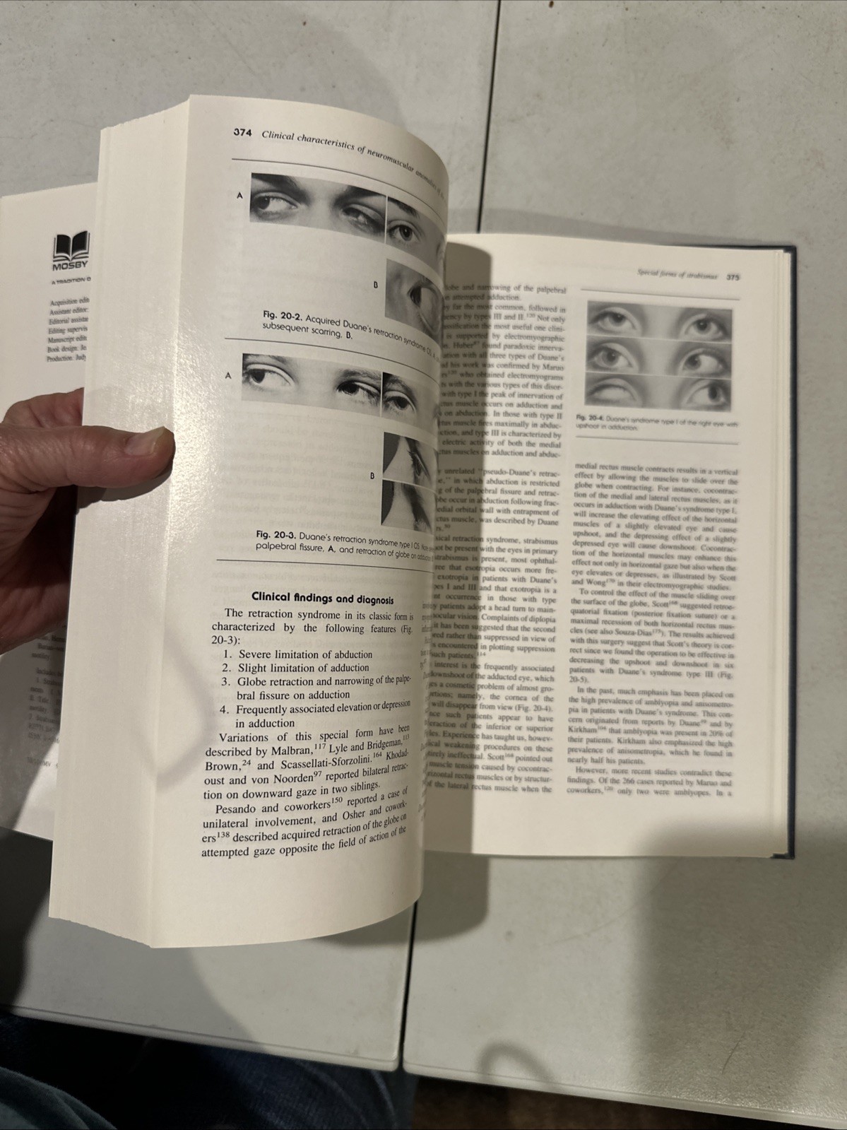 Binocular Vision And Ocular Motility. Von Noorden. 1985. Ophthalmology