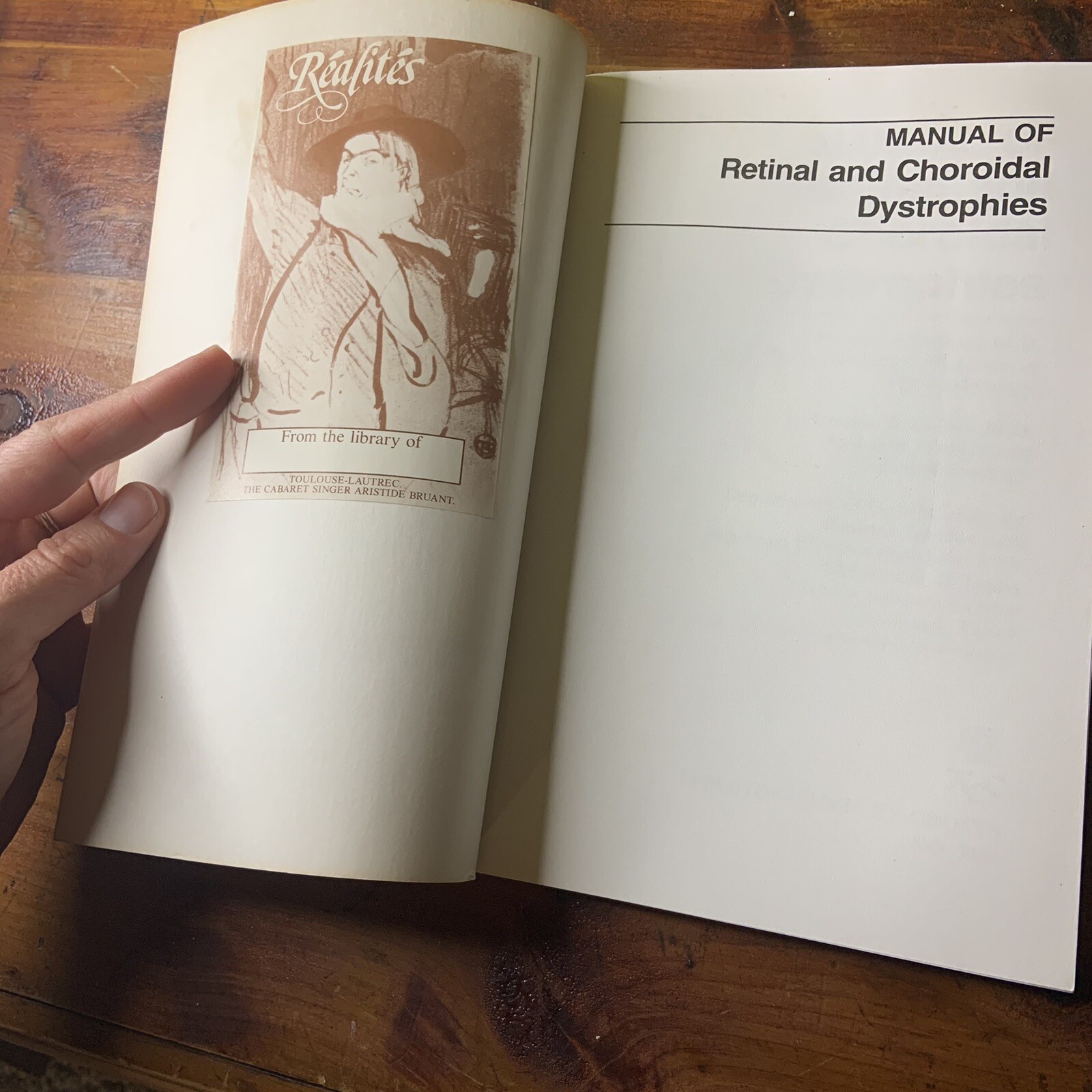 Manual of Retinal and Choroidal Dystrophies Michael Bloom Charles Garcia 1982