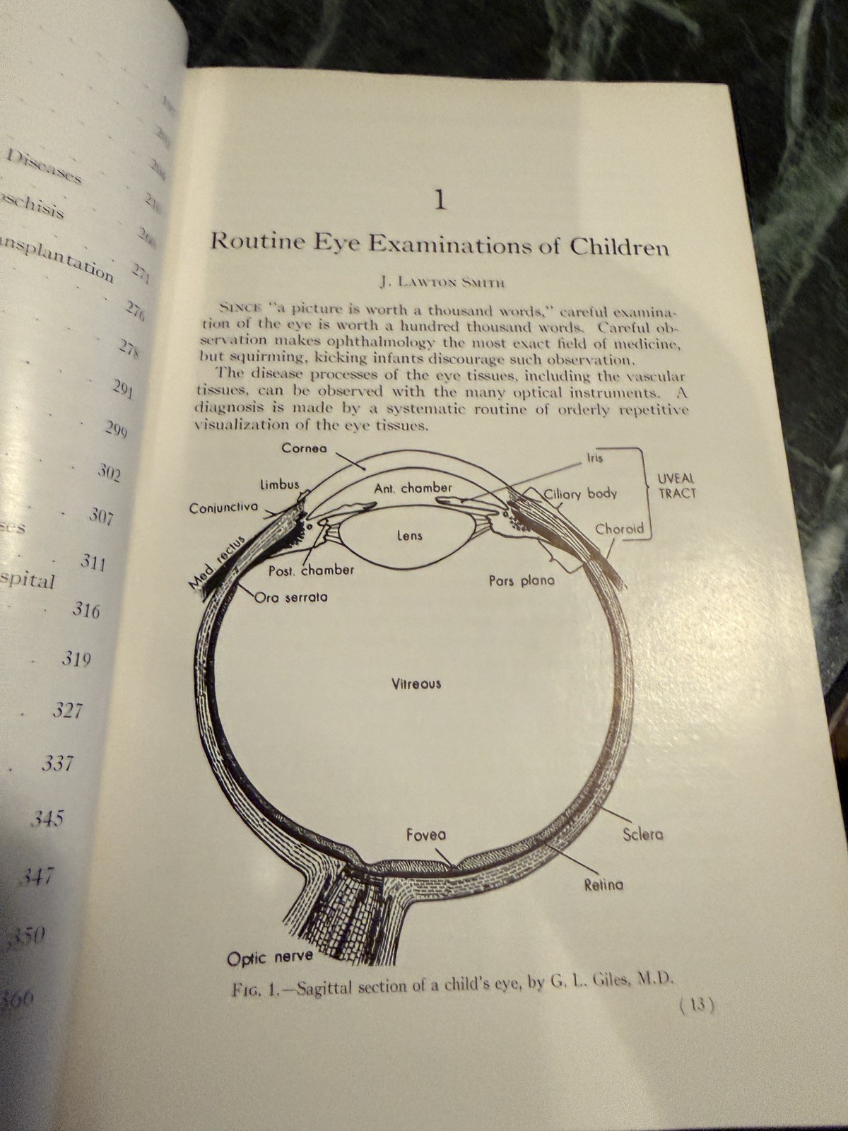 Pediatric Ophthalmology by L Byerly Holt Hardcover Book 1964 Excellent Cond