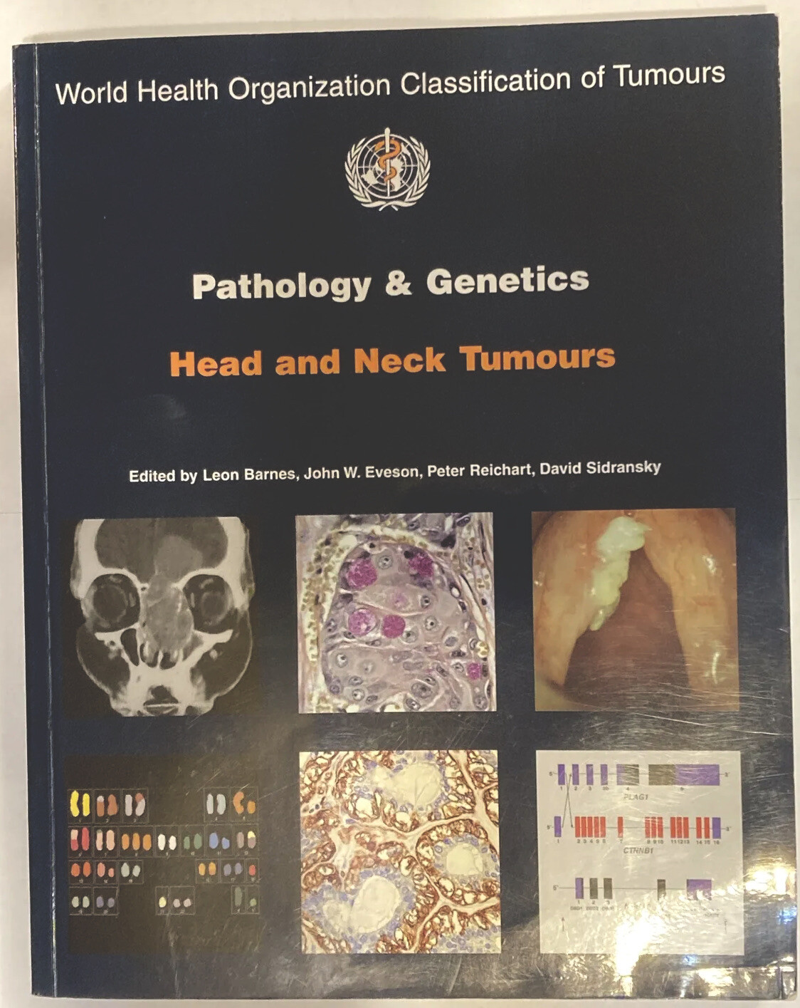 WHO Pathology and Genetics Head and Neck Tumours