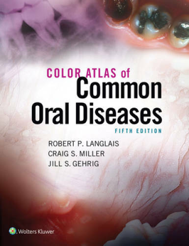 Color Atlas of Common Oral Diseases – Paperback By Langlais, Robert – GOOD