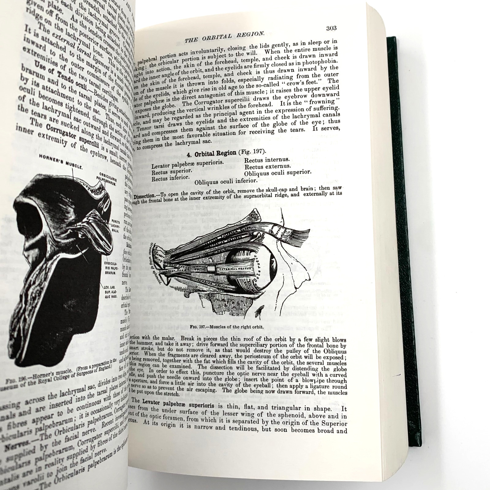 illustrated Running Press Edition of the American Classic Gray’s Anatomy HC 1974
