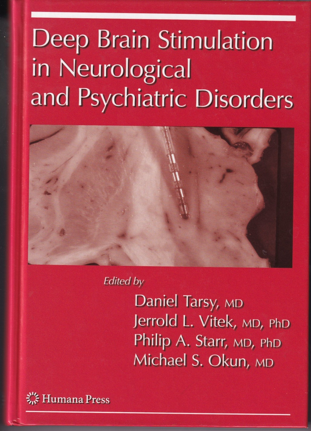 Deep Brain Stimulation in Neurological and Psychiatric Disorders (2008)