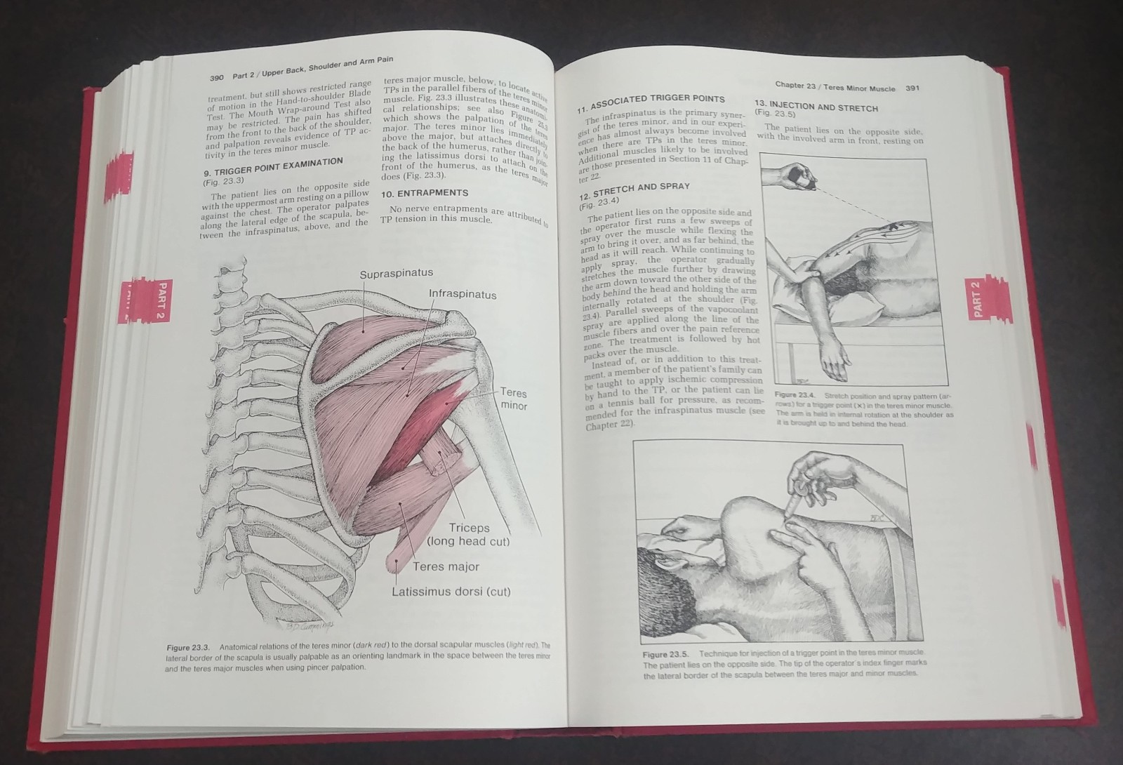 Myofascial Pain and Dysfunction: The Trigger Point Manual–Travell & Simons HC