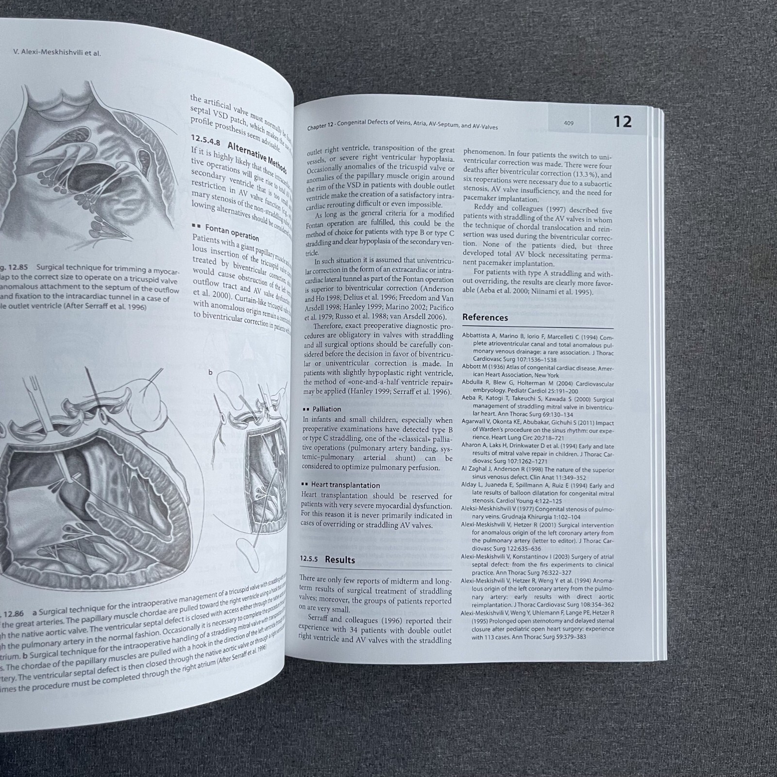 Cardiac Surgery: Operations on the Heart and Great Vessels in Adults and Childre
