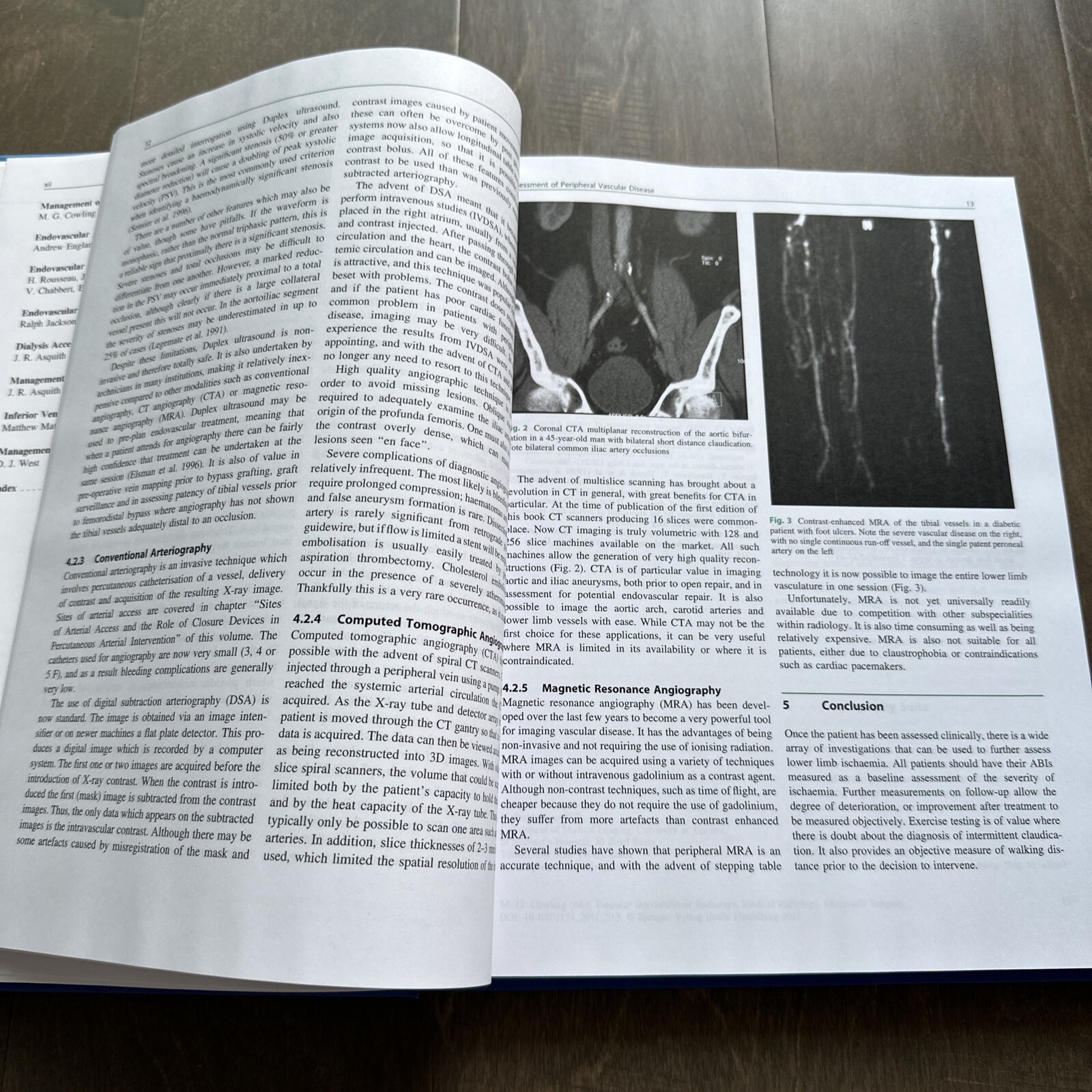 Vascular Interventional Radiology Current Evidence in Endovascular Surgery 2nd