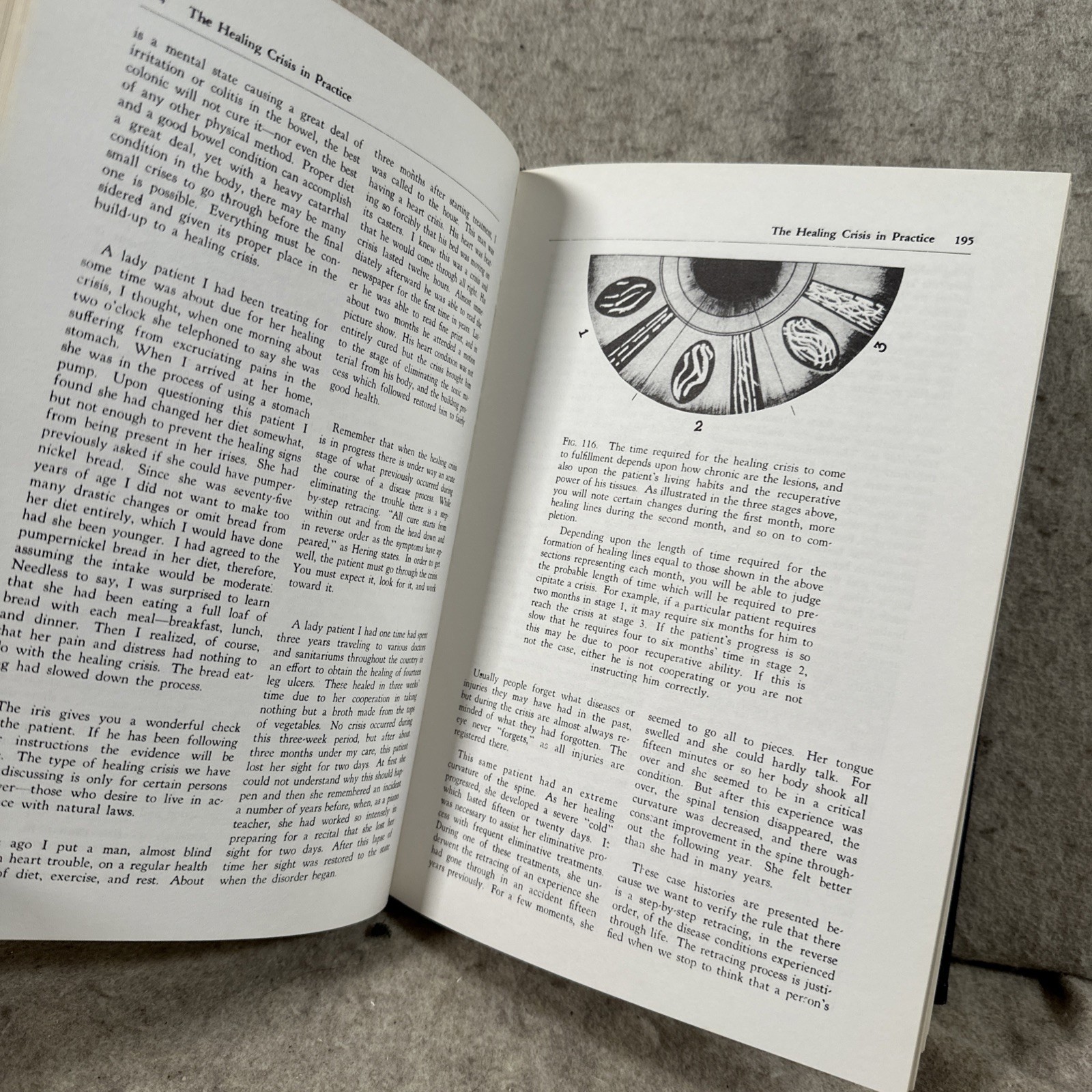 The Science and Practice of Iridology by Bernard Jensen Hardcover