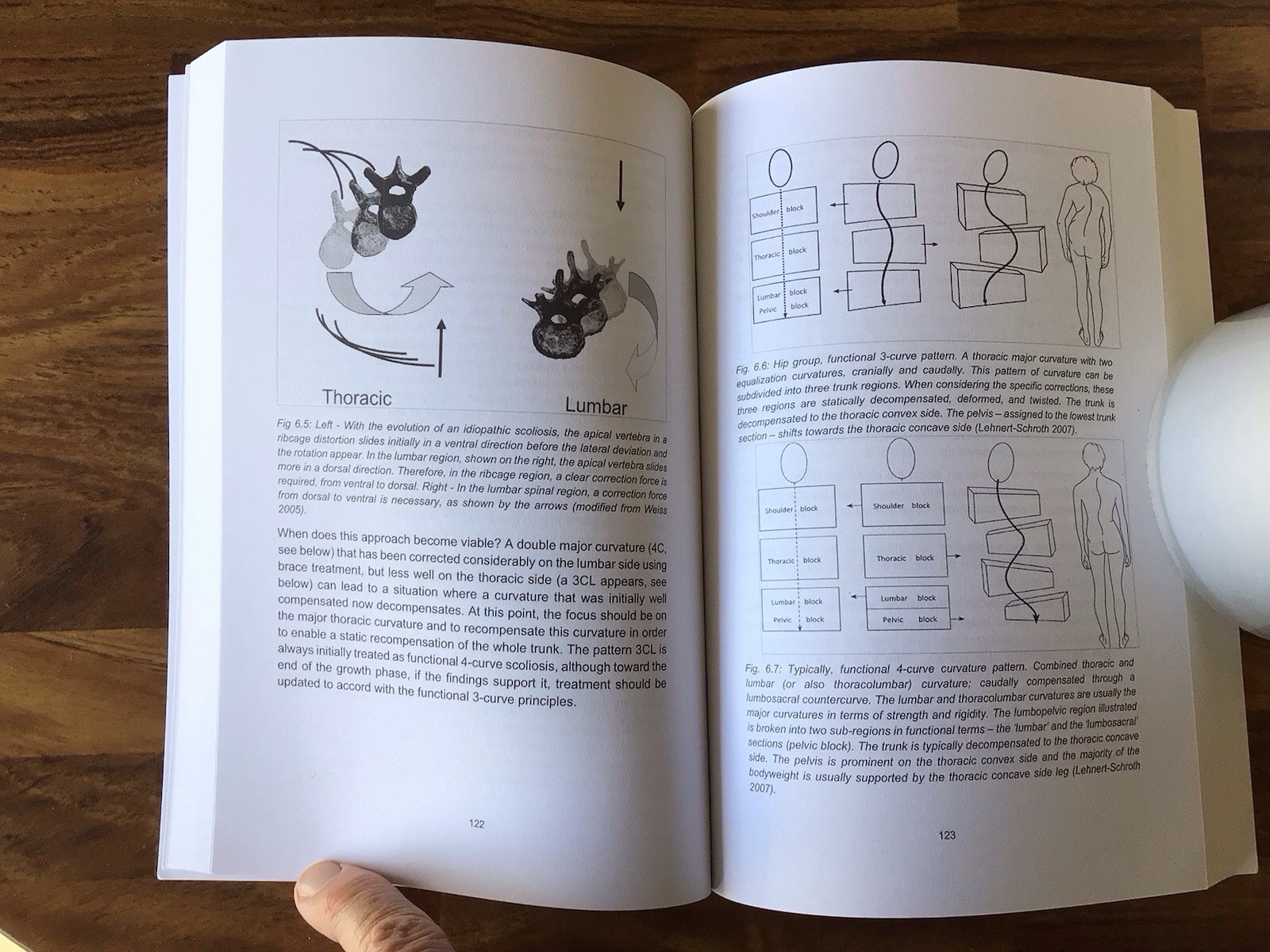 Schroth Therapy by Weiss, Moramarco, and Lehnert-Schroth, Scoliosis treatment