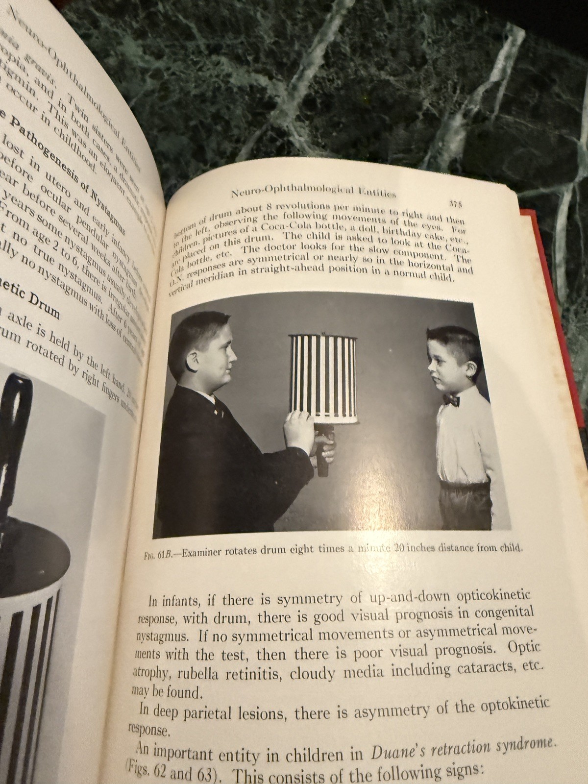 Pediatric Ophthalmology by L Byerly Holt Hardcover Book 1964 Excellent Cond