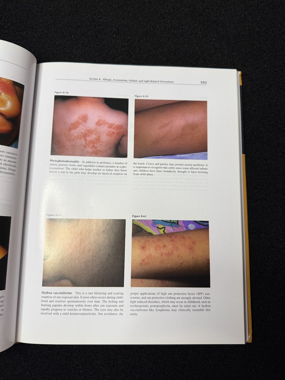 Color Atlas of Pediatric Dermatology: Fourth Edition (2008, Hardcover)