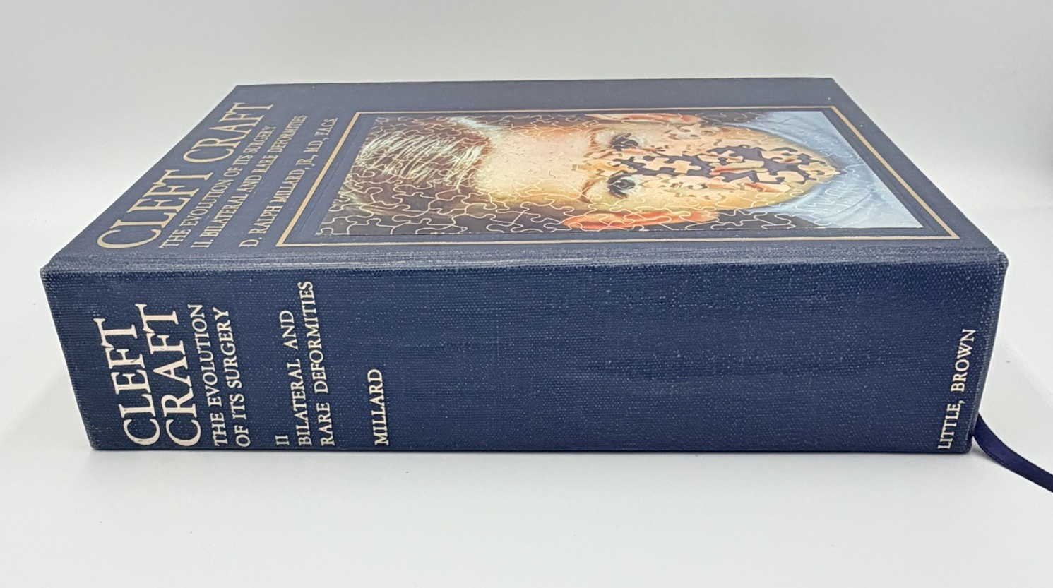 Cleft Craft Vol 2 Evolution Of Its Surgery The Unilateral Deformity Millard 1977