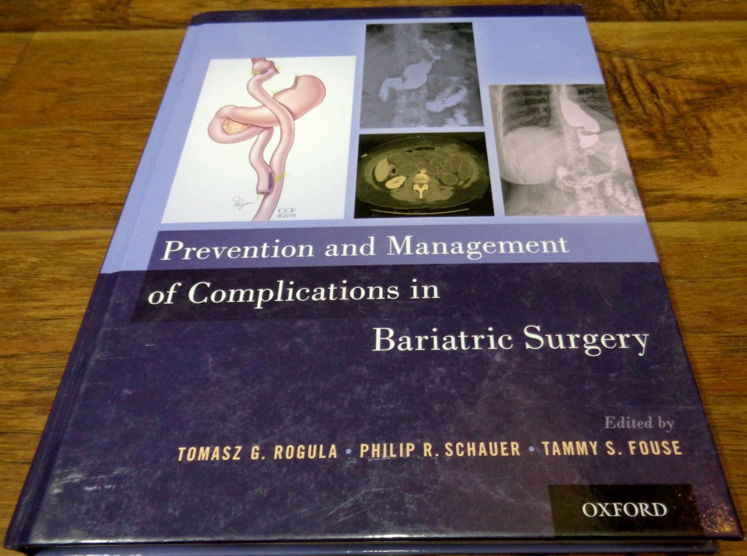 PREVENTION AND MANAGEMENT OF COMPLICATIONS IN BARIATRIC SURGERY (OXFORD HC)